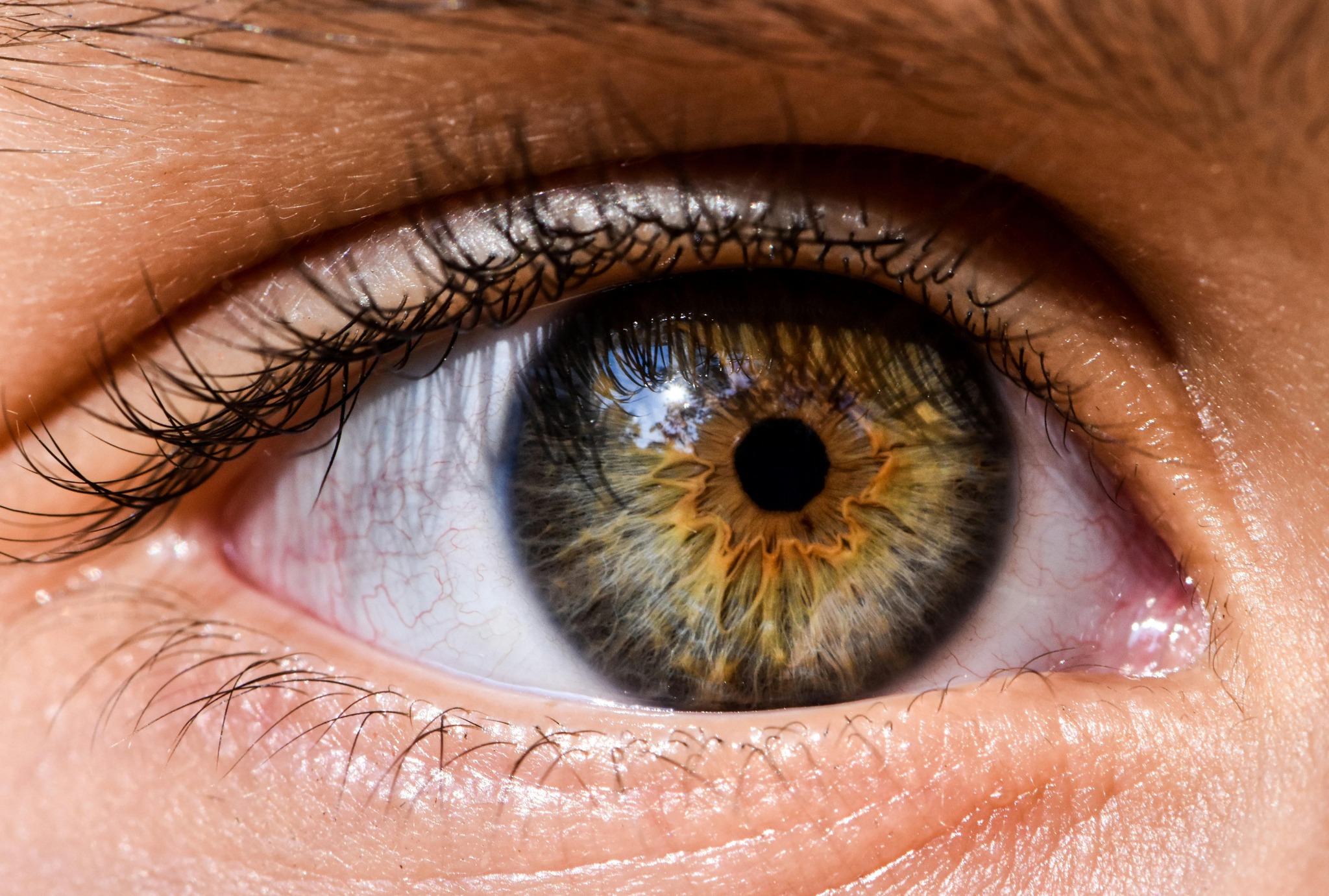 Seeta Eye - Retinal imaging is cutting-edge technology... | Facebook