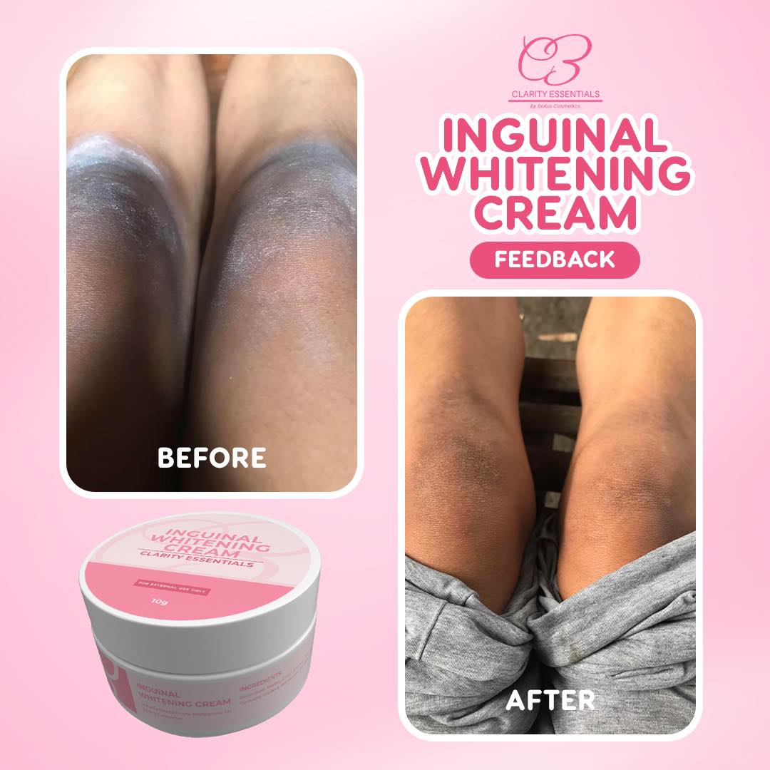 Your body deserves care without shame. 💖😍 Our Inguinal Whitening Cream is crafted to support brighter, more even-toned skin gently and effectively.🤗 Link here: https://vt.tiktok.com/ZSHoYHk8b8oUR-PYuYN/ #InguinalWhiteningCream #IntimateGlow 