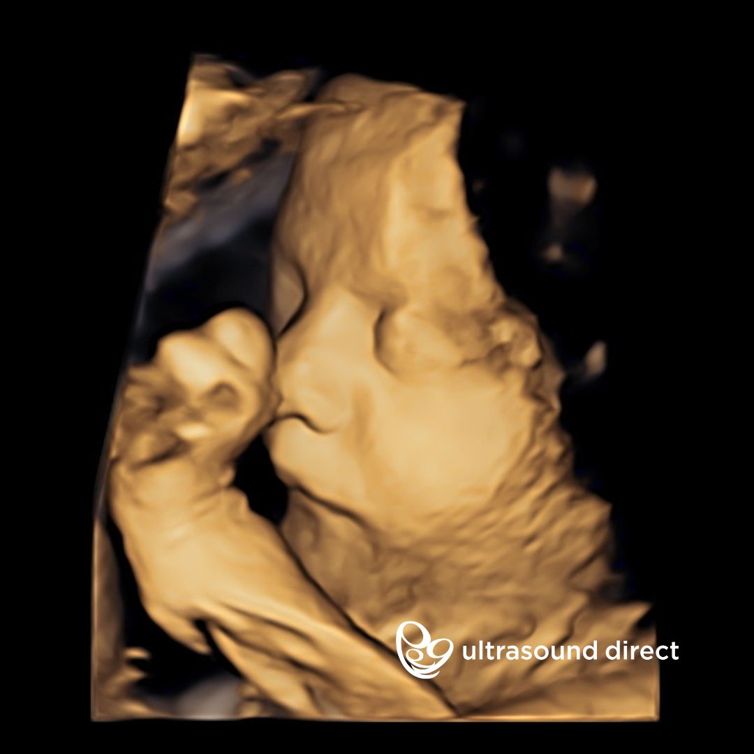 Ultrasound - Our 4D Bonding Scans allow you to enjoy extra time seeing ...