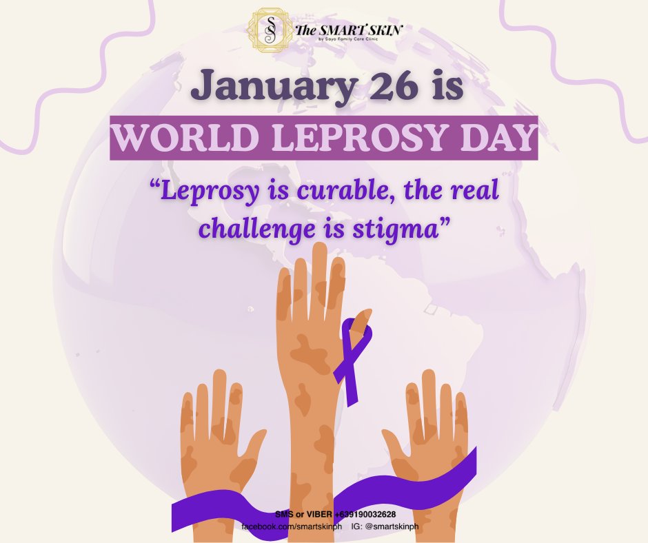 Leprosy is curable. Stigma is not. On this Anti-Leprosy Day (Jan