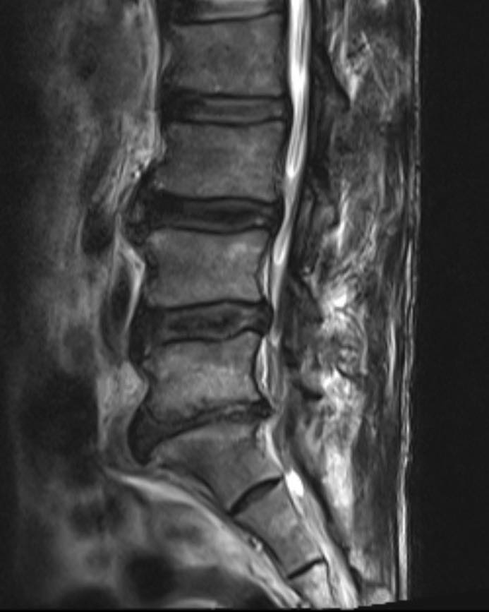 黃立人 - DePuySynthes,Johnson & Johnson MatrixRib plating system 在過去這10年時間 ...