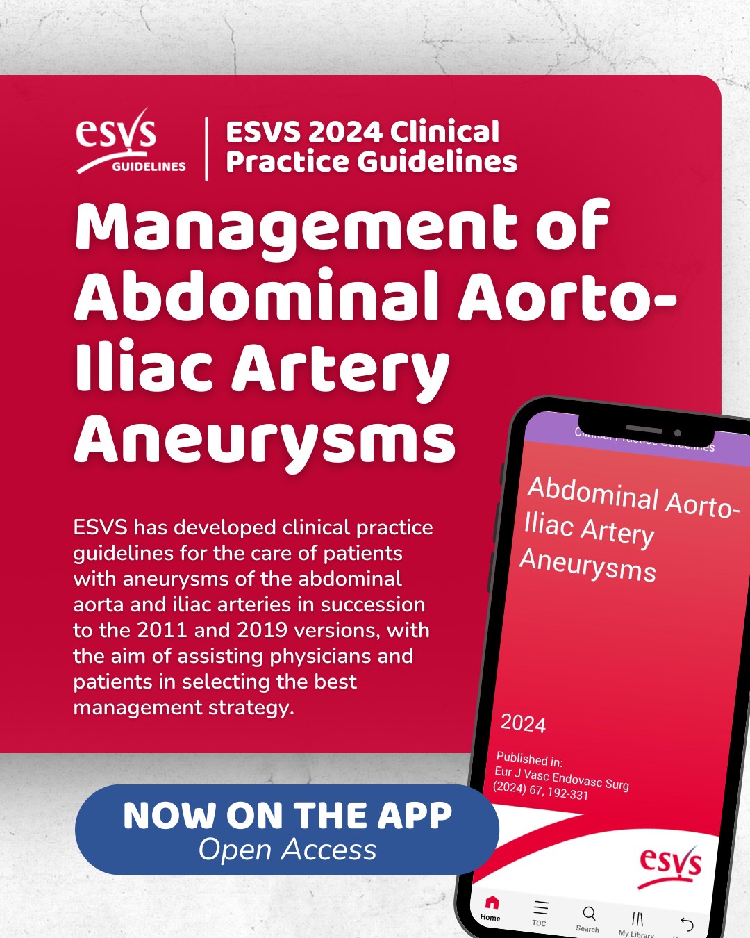 ESVS - 📱 New on the ESVS Guidelines App! 🆕 Just added to the ESVS ...