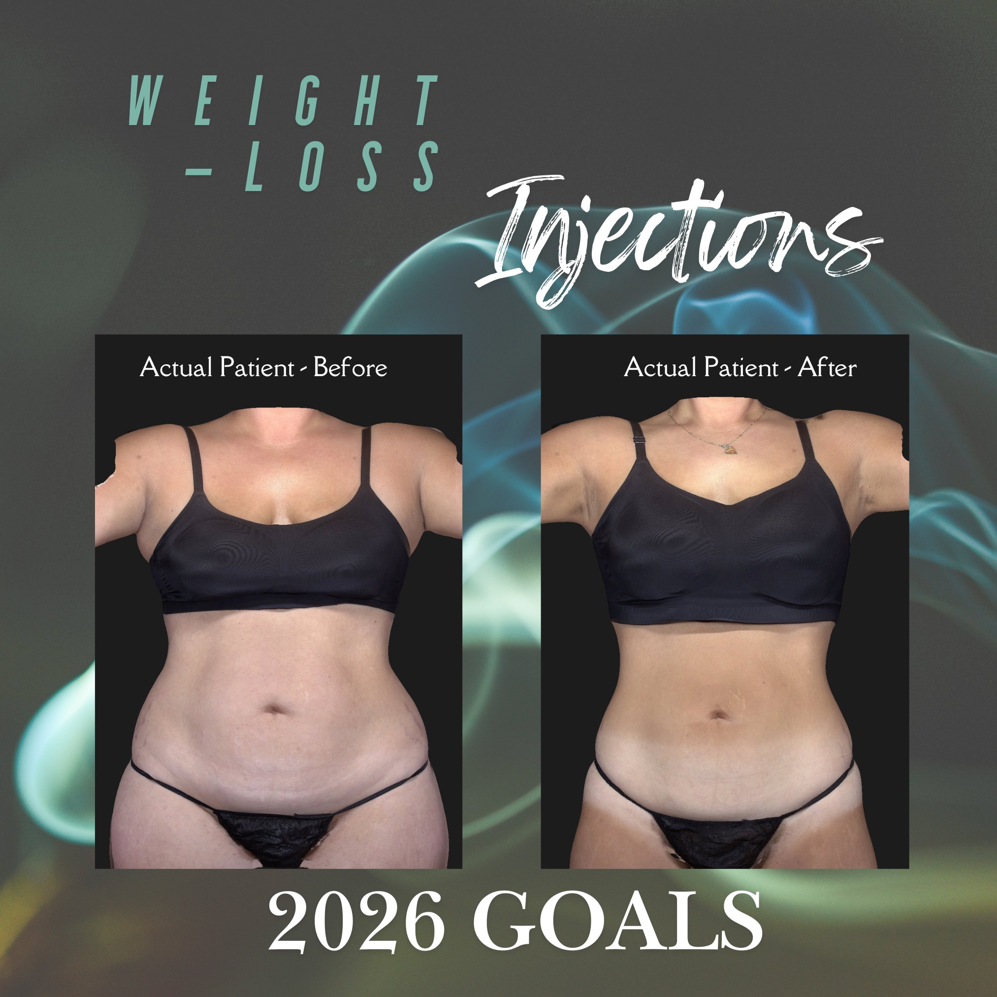Our slim shots can help you reach your weight-loss goals for 2026 while also protecting you against heart and kidney disease! For more information about our slim shots, TEXT 