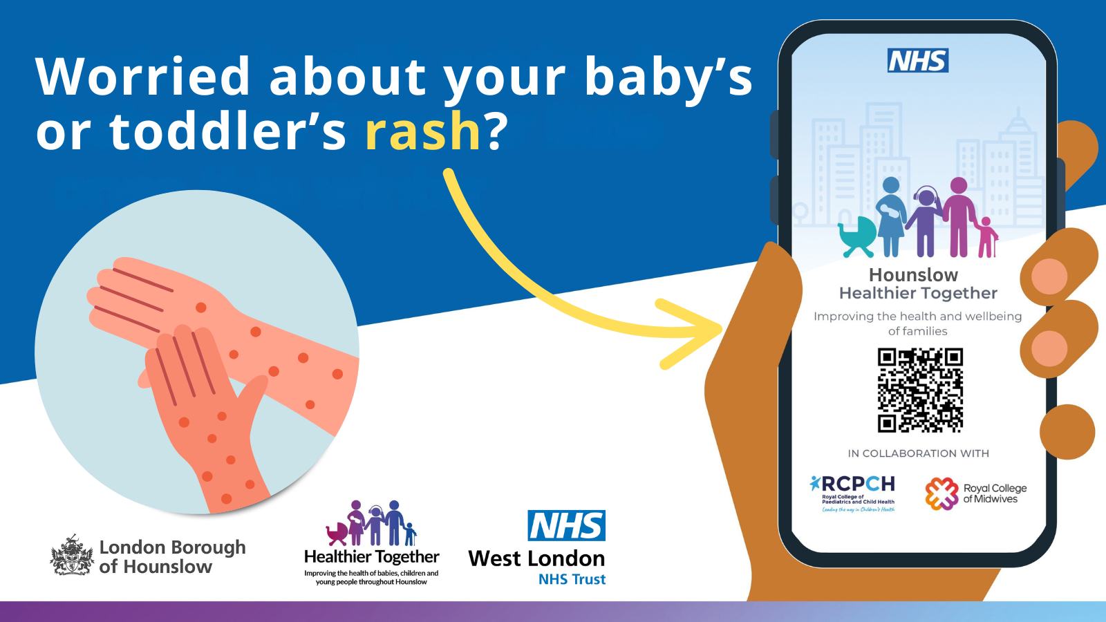 West - If you are worried about a rash on your baby or child, CHECK ...