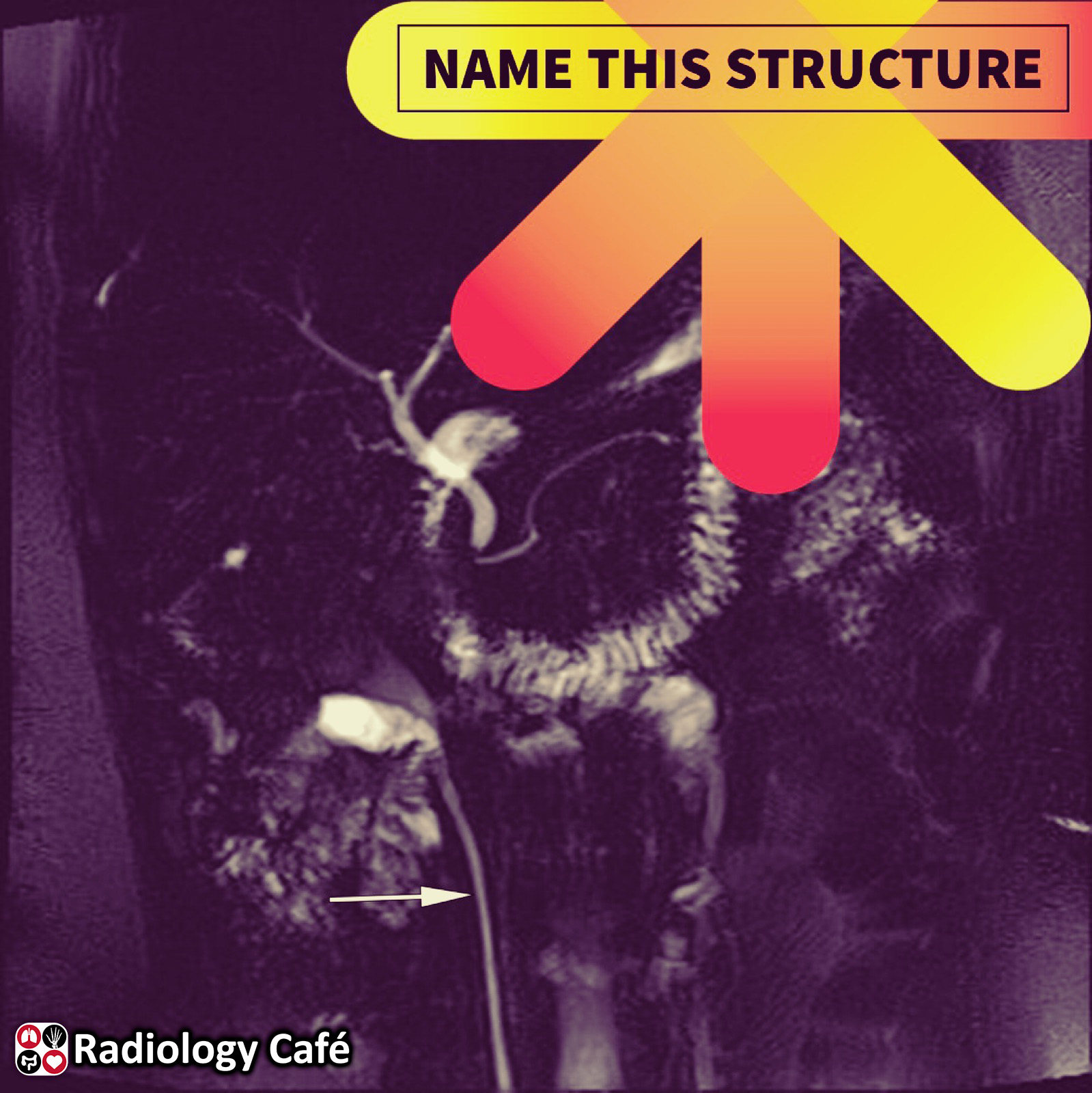 Radiology Cafe