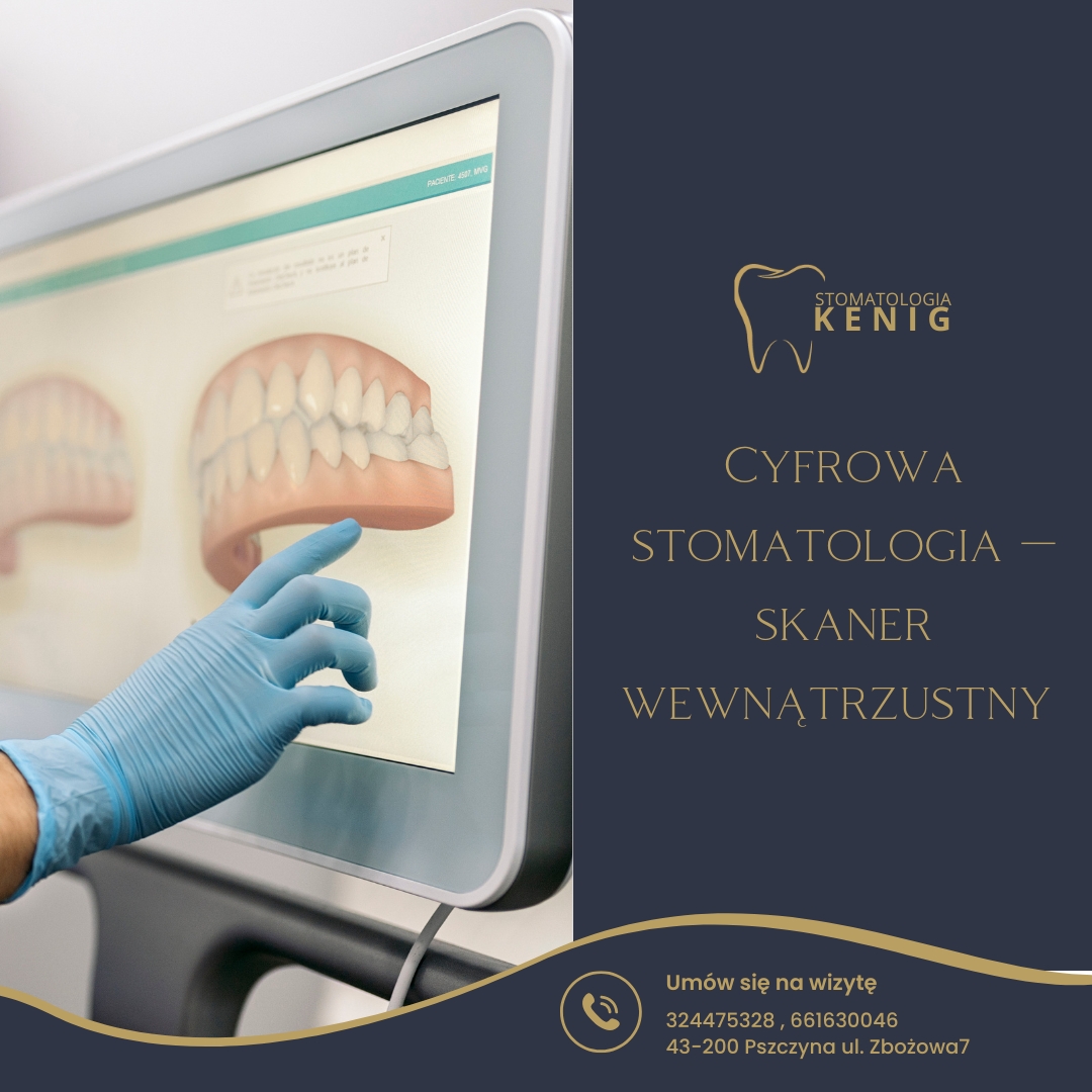 Stomatologia Kenig lek.dent. Katarzyna Kenig | Pszczyna