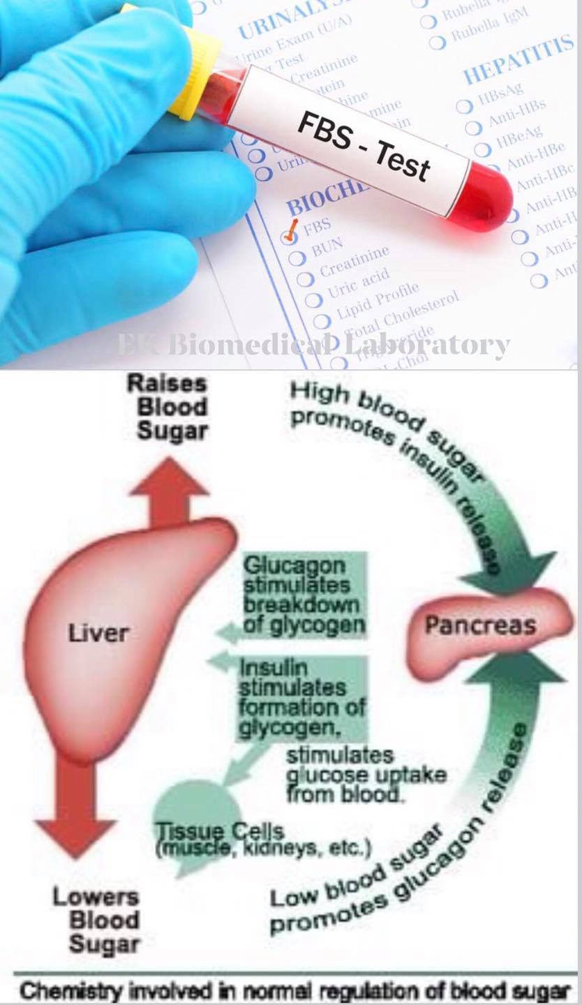 Fasting Blood Sugar (FBS or... - VK Medical Laboratory | Facebook