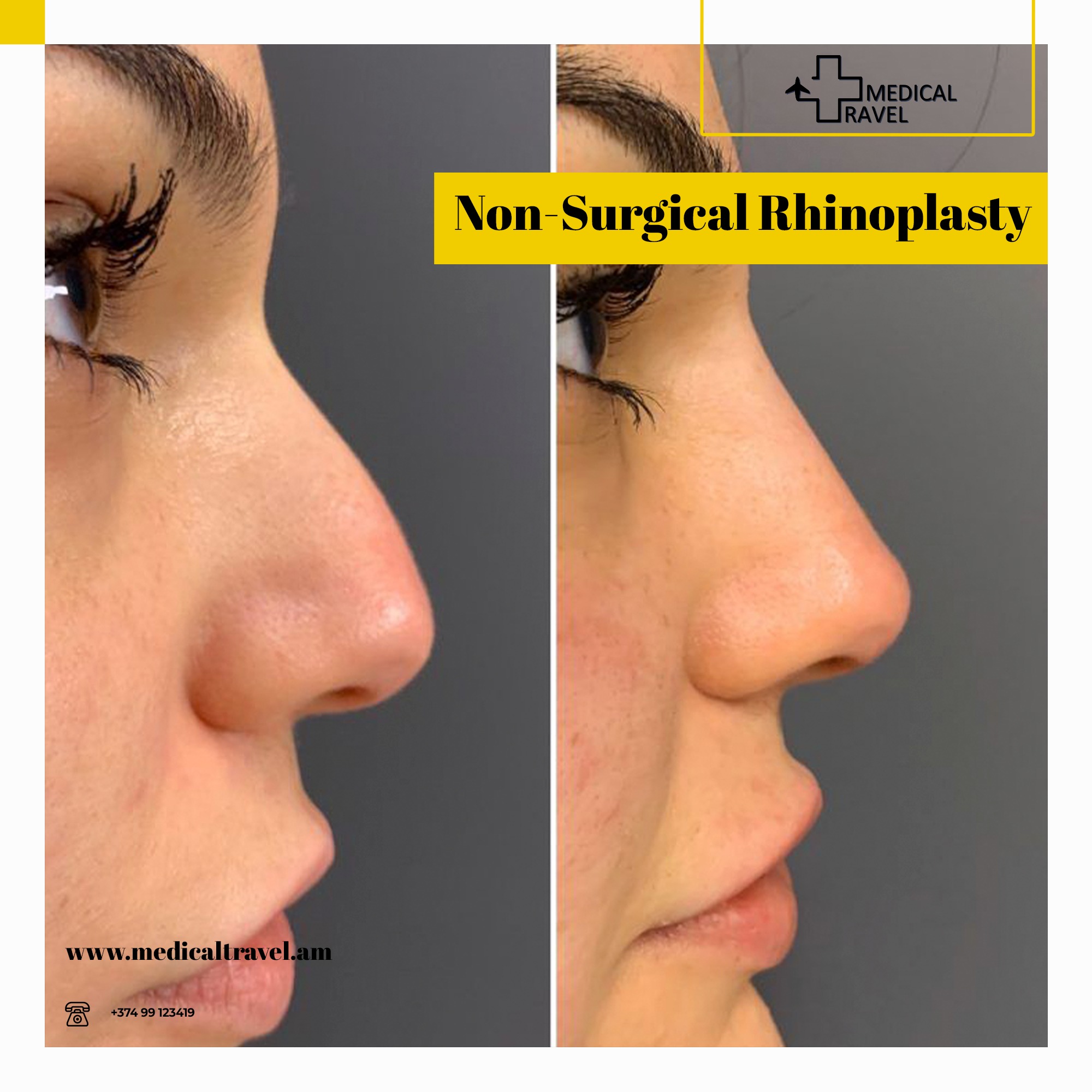 Medical Travel - 🔸 External correction of the appearance...