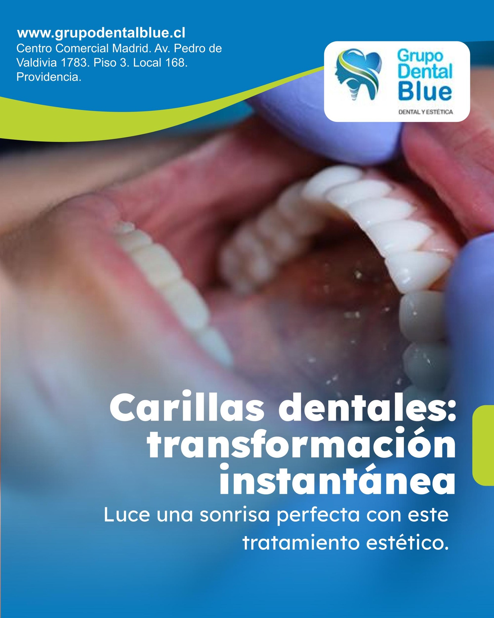 Clinicas Blue Dental Estetica - Las valplast son unas protesis dentales ...
