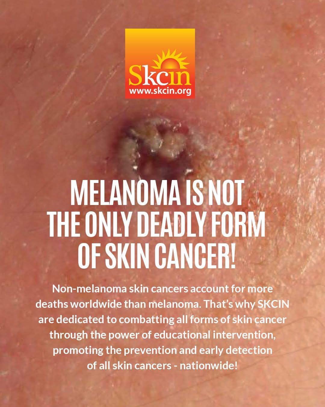 is melanotan permanent 50 Weeks on Melanotan2. Used to be Type 1 and never able to tan. Have never felt better! Beard color change epic : r/Melanotan2 Do you know it is