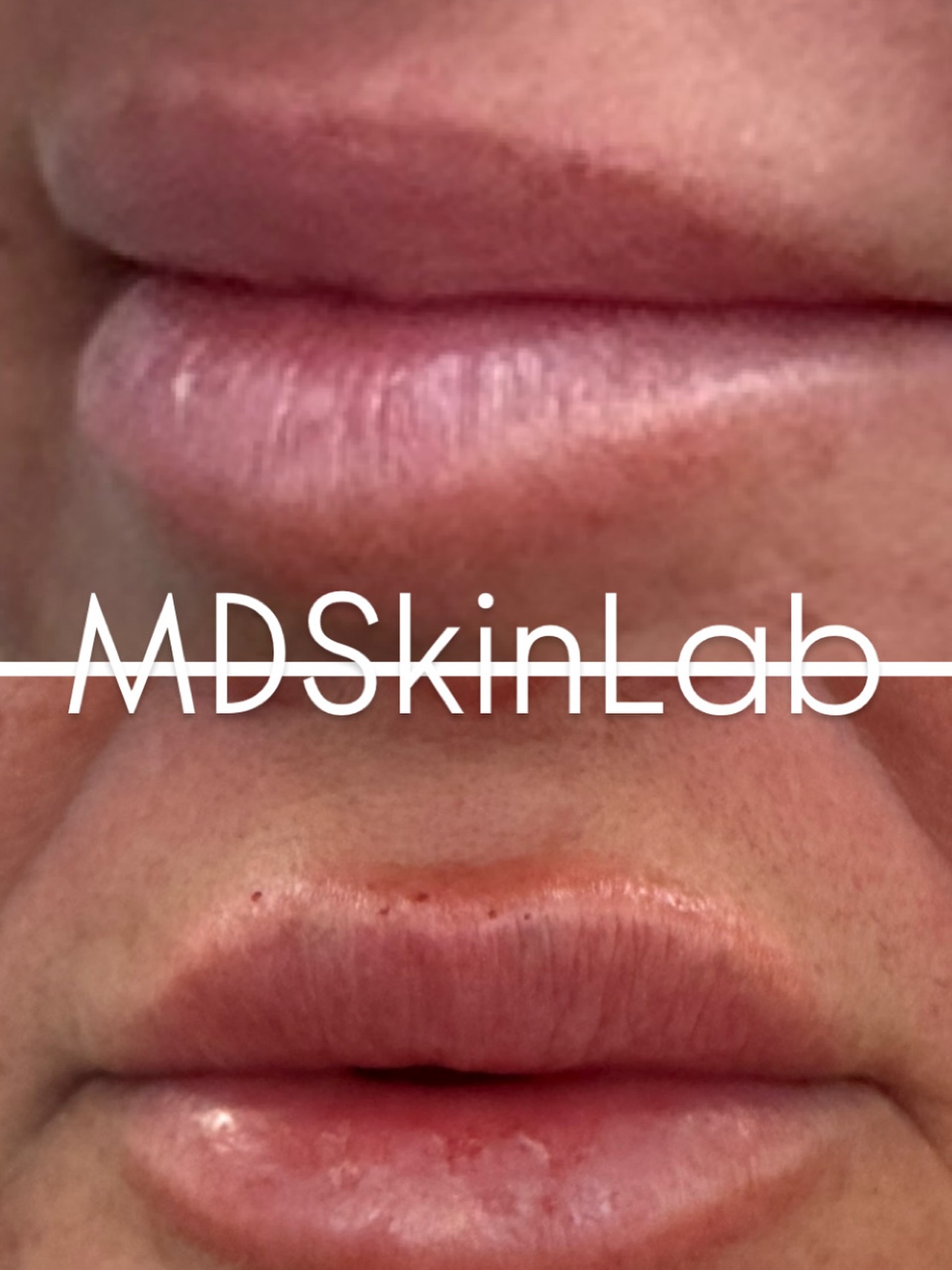 MD Skin Lab
