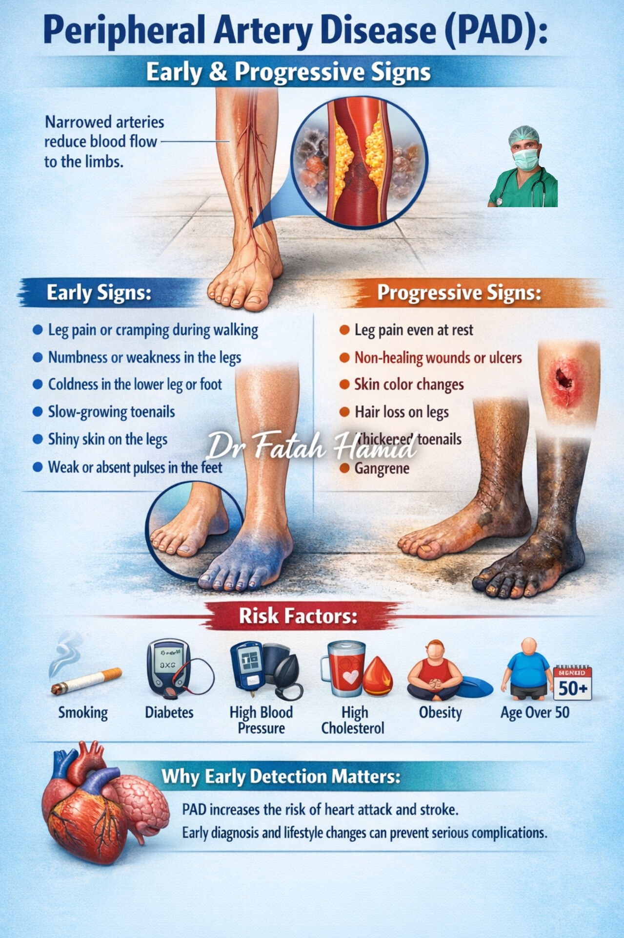 Dr - Peripheral Artery Disease (PAD): Early & Progressive Signs ...