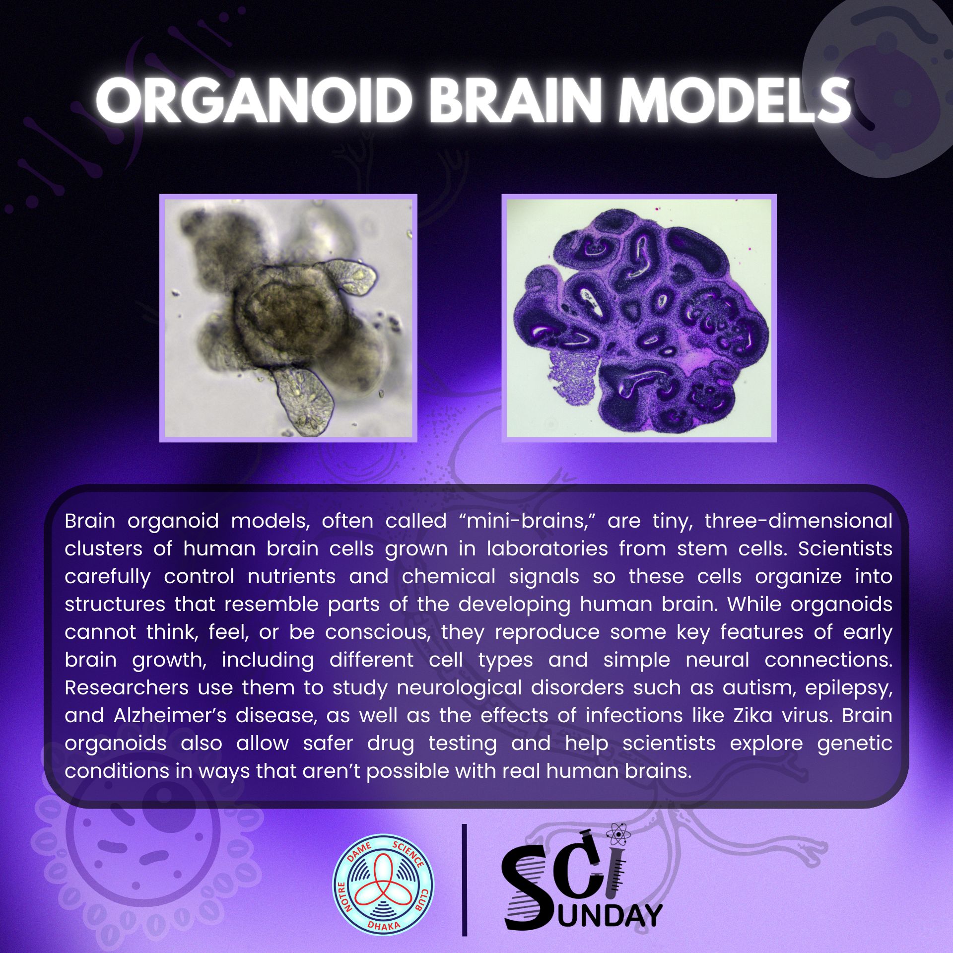 Notre - Organoid Brain Models represent a groundbreaking advancement in ...