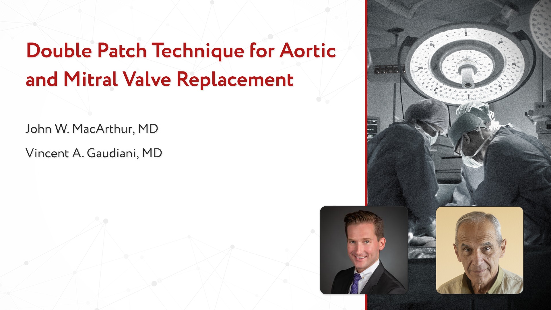 CTSNet - Double Patch Technique for Aortic & Mitral Valve Replacement ...