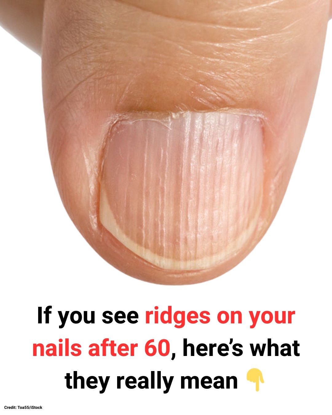 Modern - If you see ridges on your nails after 60, here’s what they ...