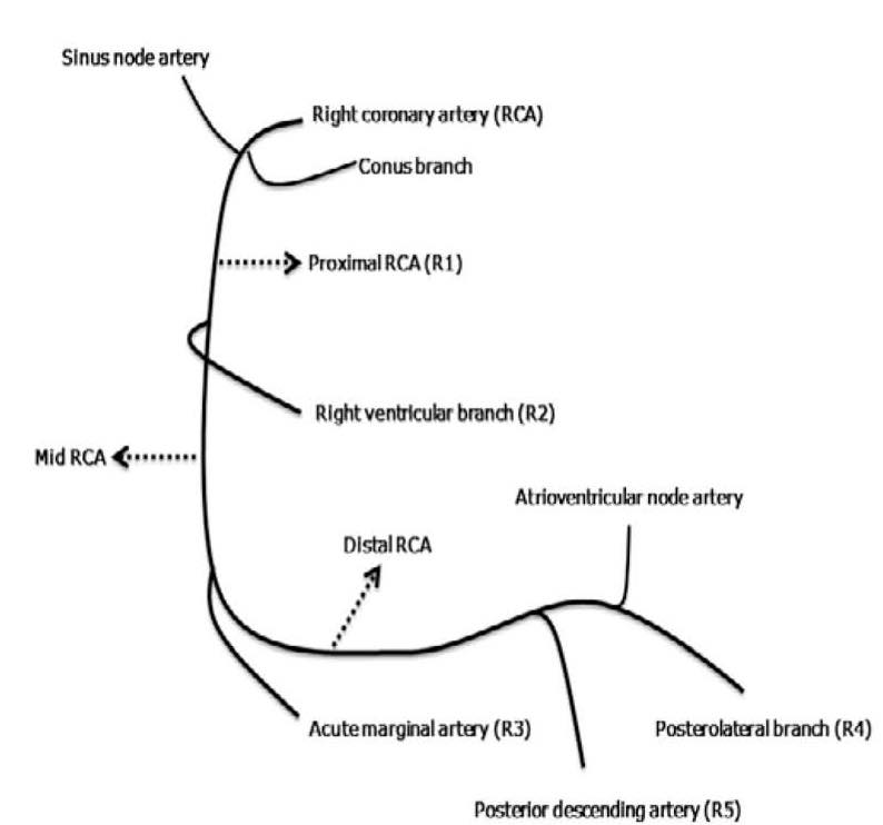 Cardiophilia - Atrial Flutter : Conduction & Ventricular... | Facebook