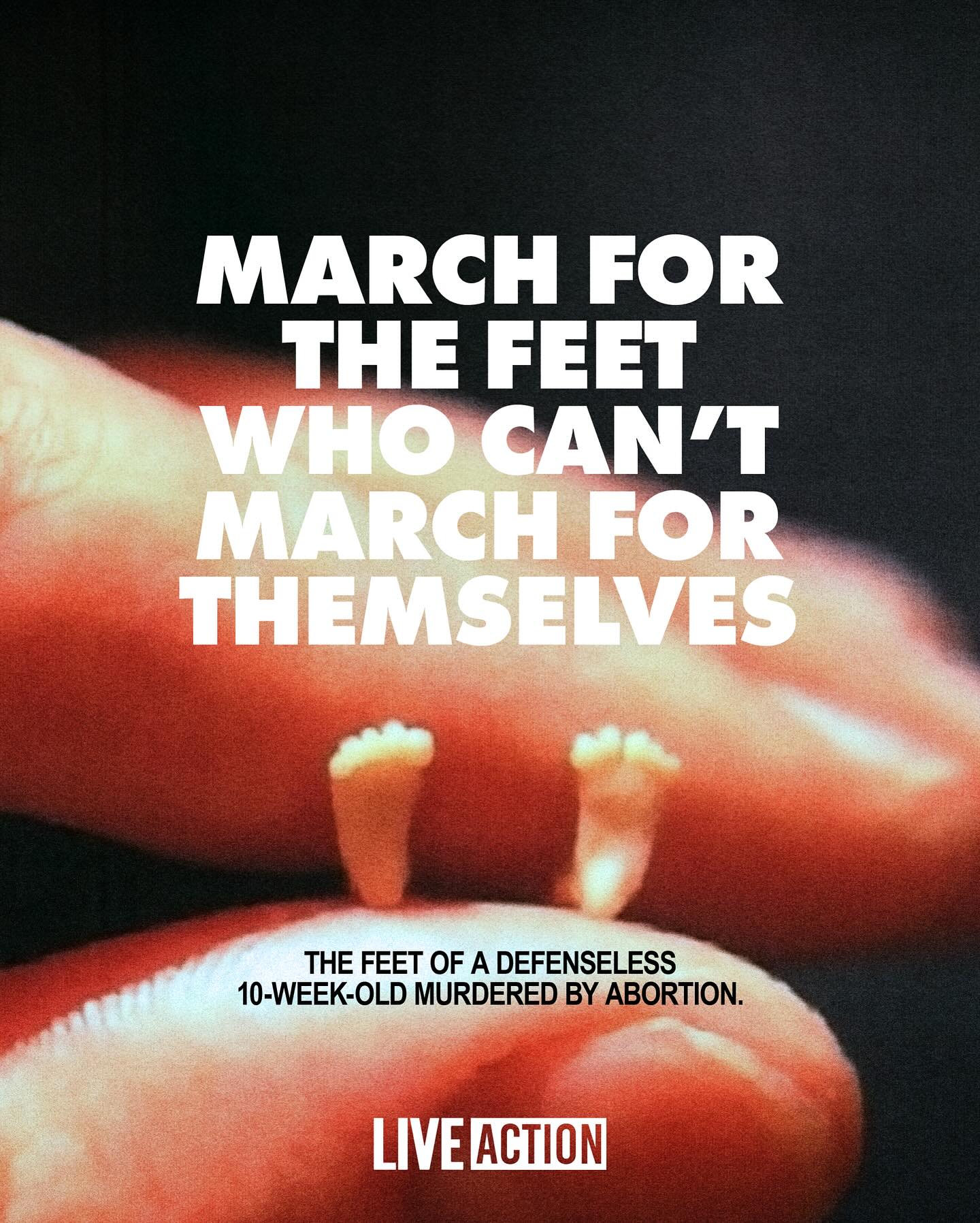 Live Action - These are the precious feet of a 10-week-old... | Facebook