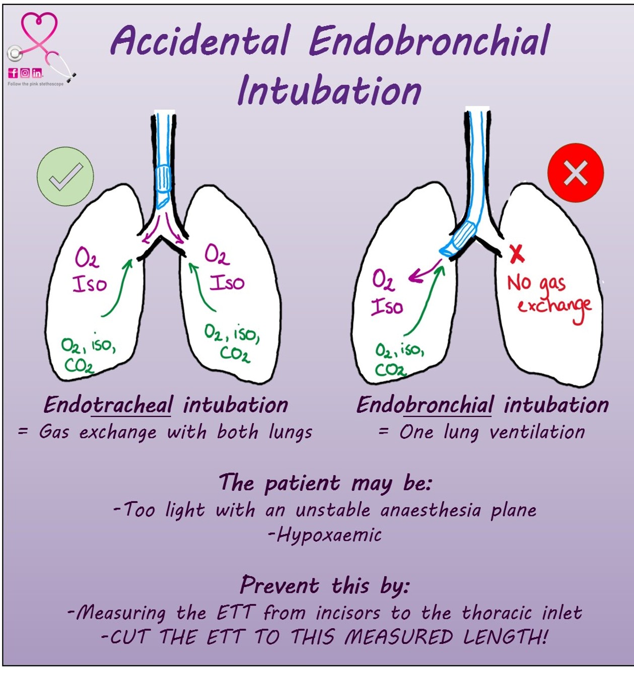 ACCIDENTAL ENDOBRONCHIAL INTUBATION... - The pink stethoscope