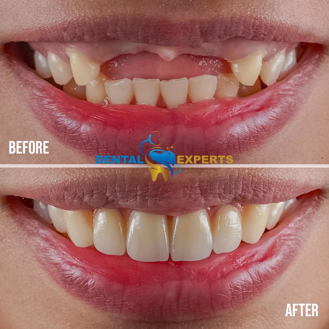 A smile designed with precision of a masterpiece. With the launch