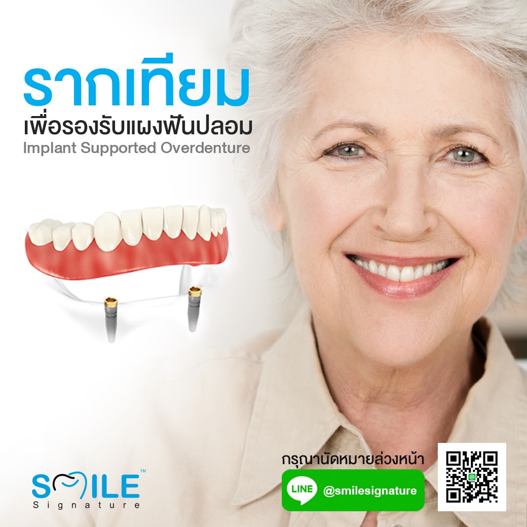 เพิ่มความมั่นคงให้แก่แผงฟันปลอมไม่ให้หลุดหลวมขณะใส่ ด้วยการทำรากฟัน ...