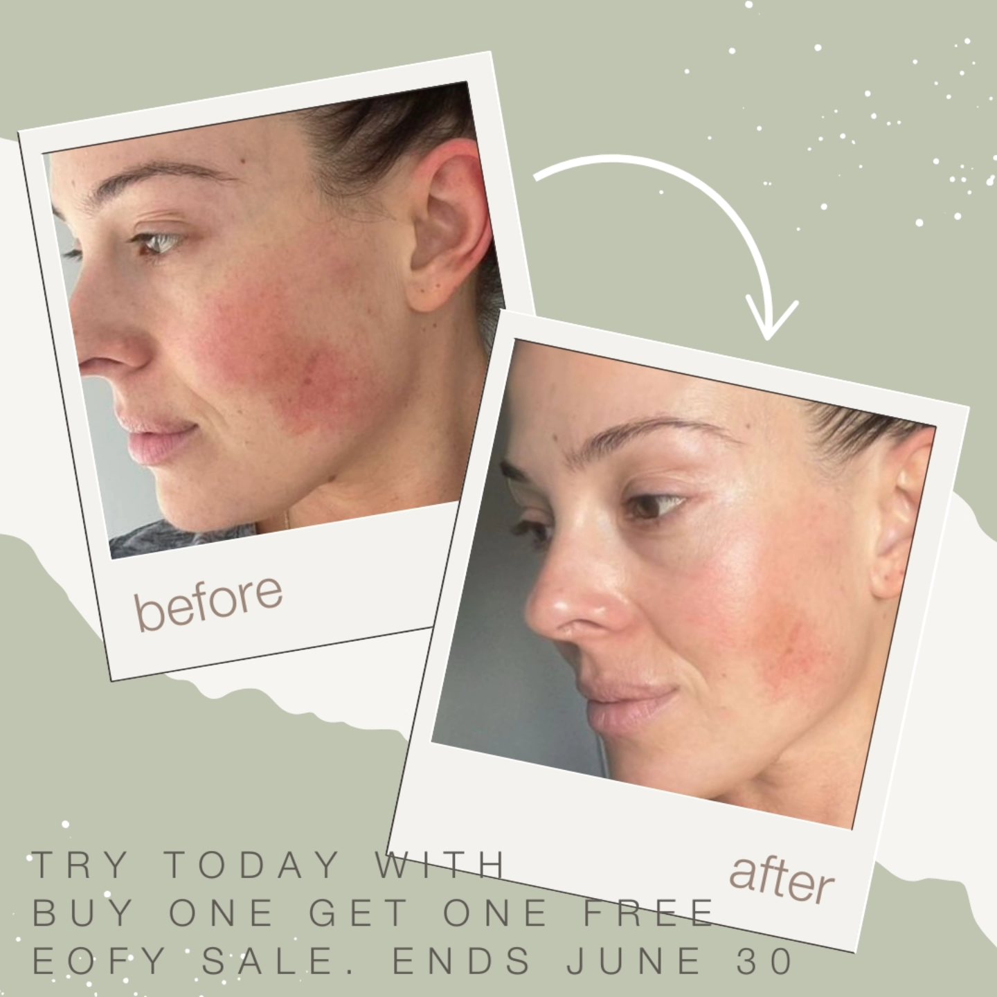 SEEH Skincare