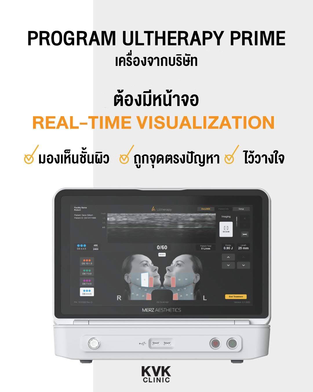 KVK - KVKClinic พาชี้จุด สังเกตให้ดี! เครื่อง Program Ultherapy Prime ...