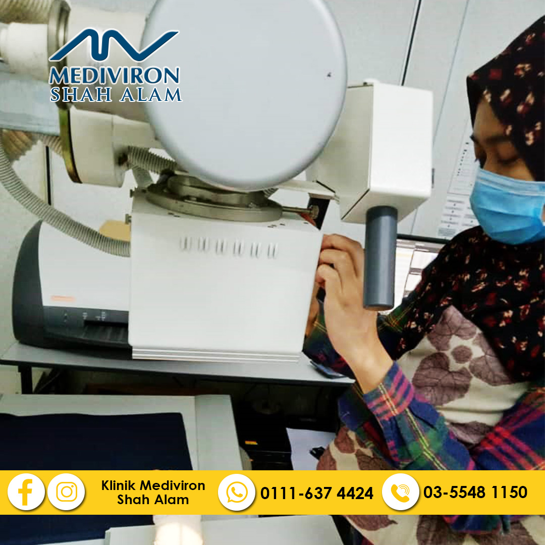 Perkhidmatan Xray Klinik Klinik Mediviron Shah Alam Facebook