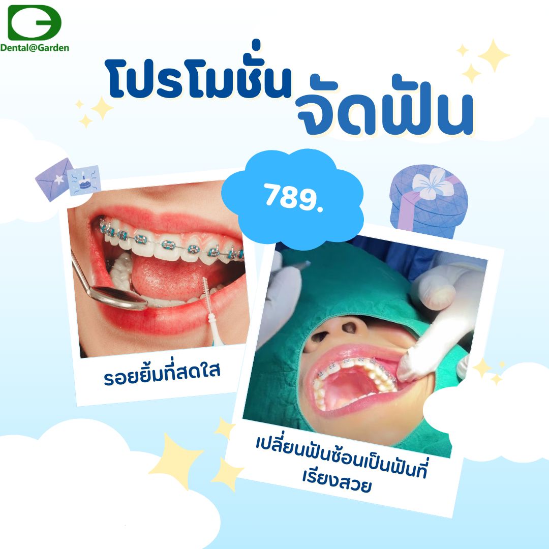คลินิกทันตกรรมบ้านสวน - #โปรโมชั่นรออยู่ 📢มาเป็นเจ้าของรอยยิ้มที่สดใส ...