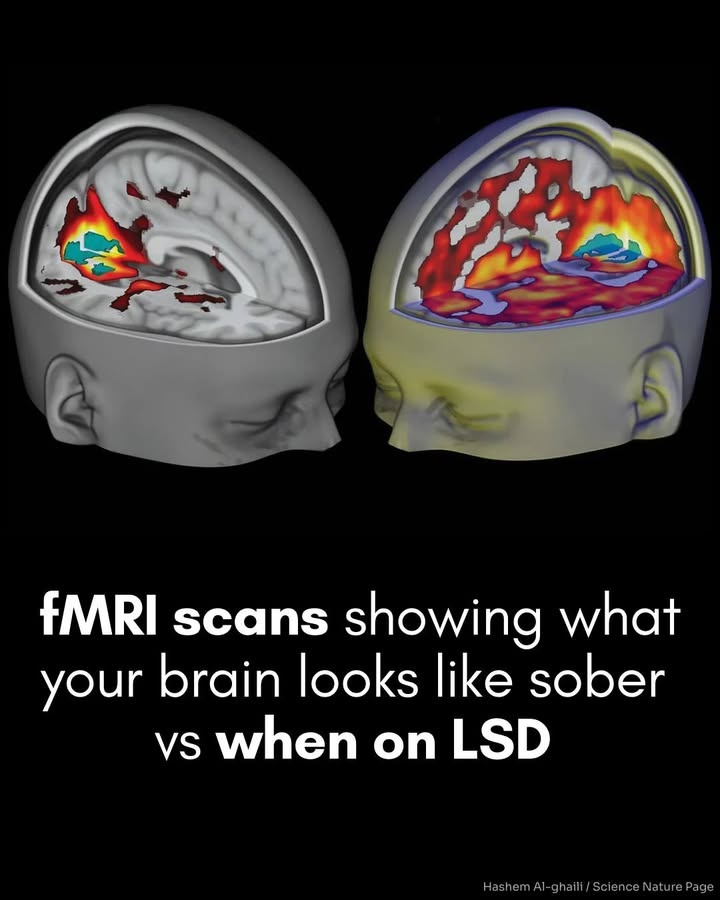 Engineering - Scientists scanned the brain on LSD — and what they found ...