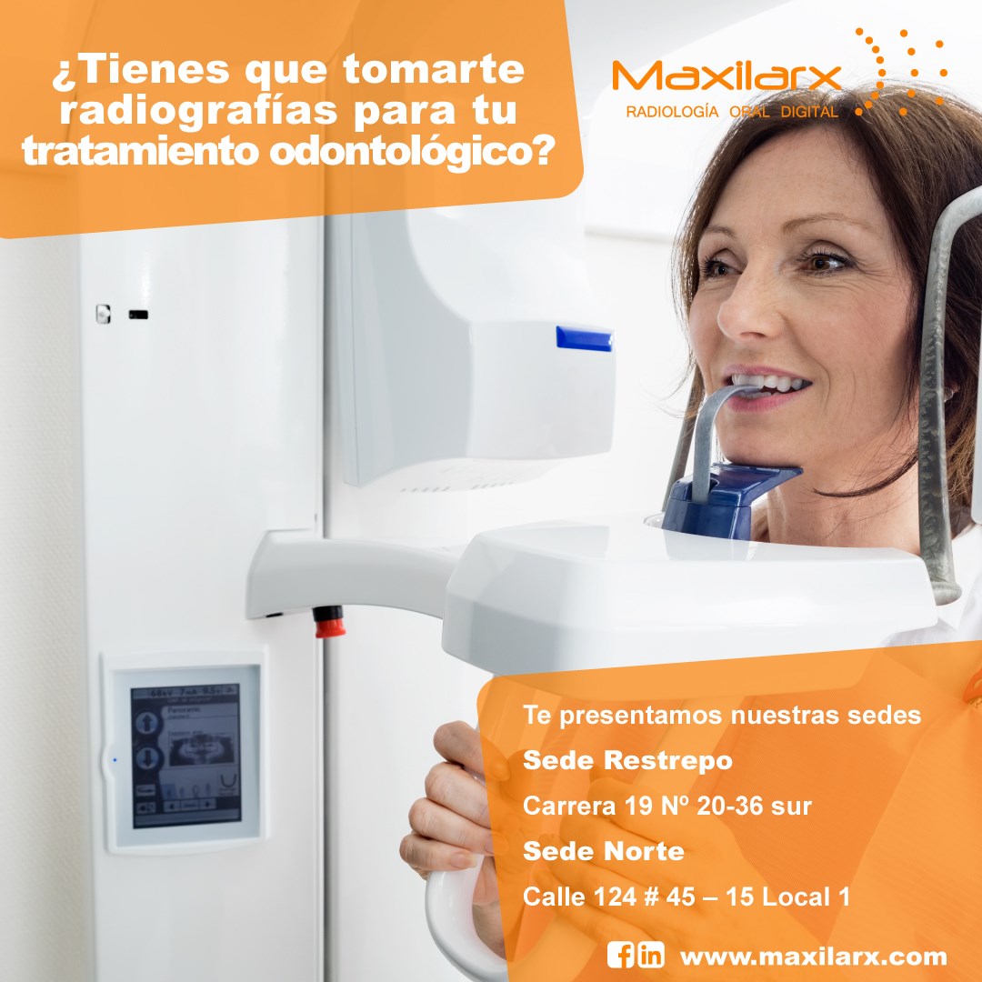 Los diagnósticos... - Maxilarx Radiología Oral Digital