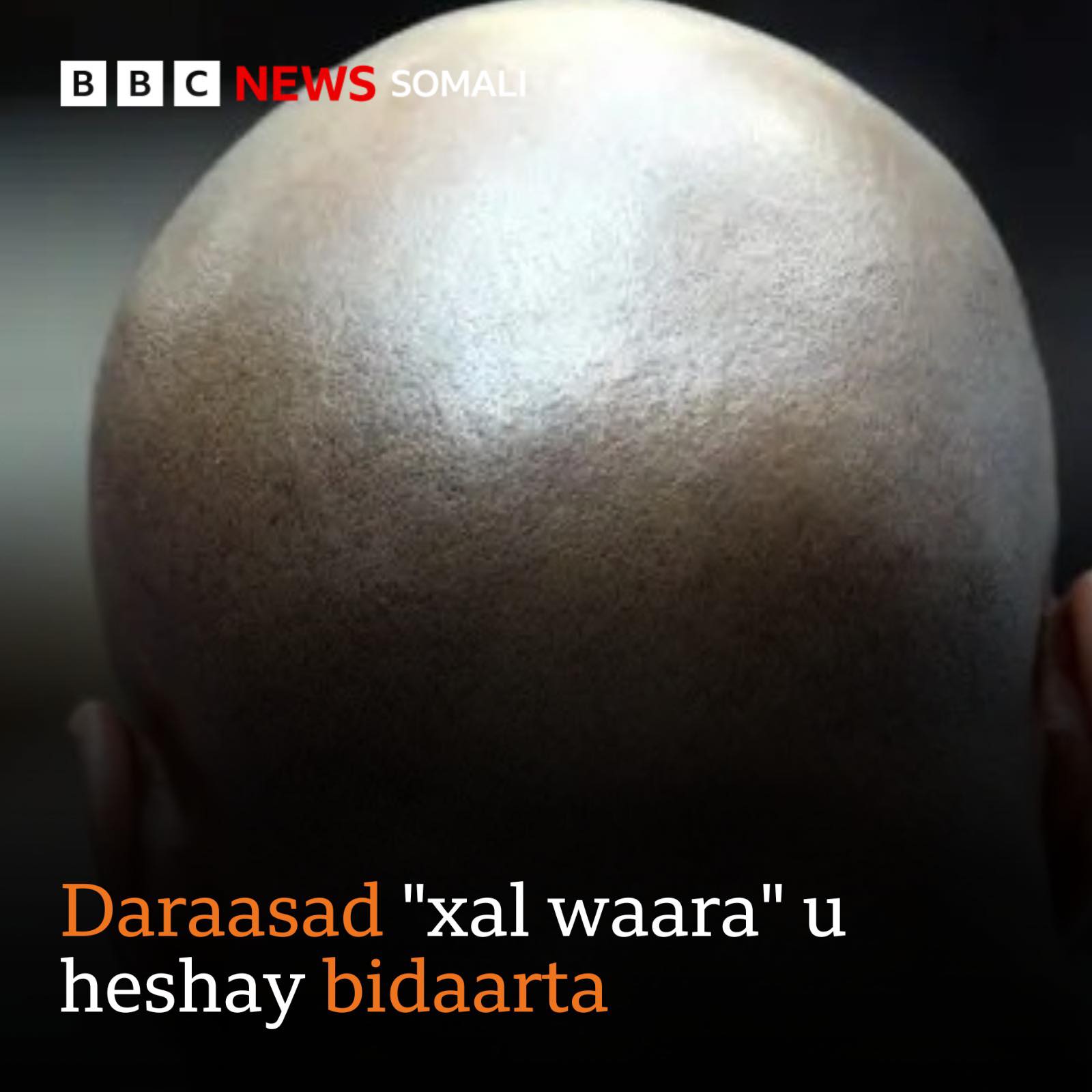 BBC News Somali - Cilmi-baarayaal ayaa ka shaqeeyey tobaan... | Facebook