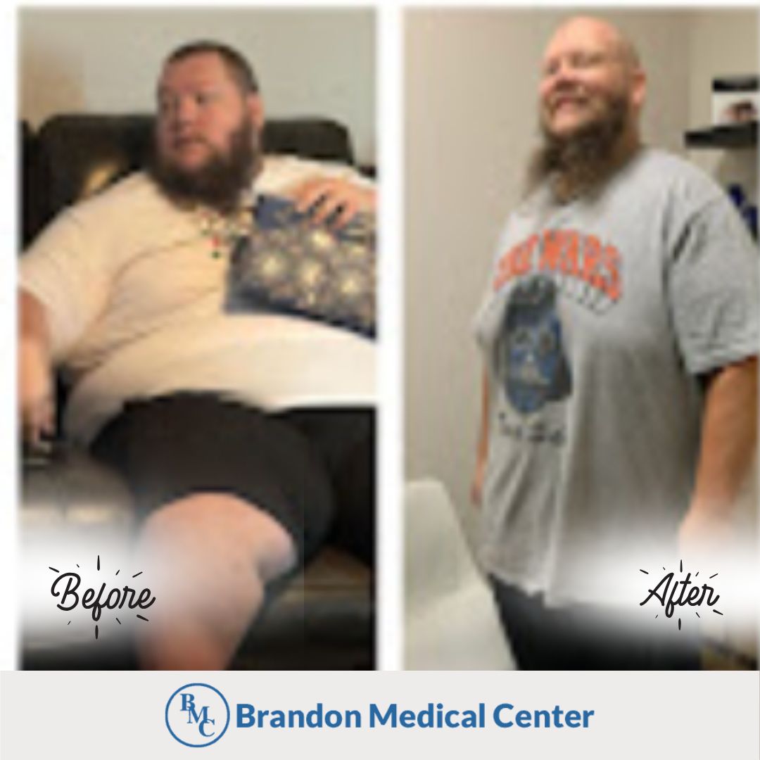 brandon lewis weight loss Image 8