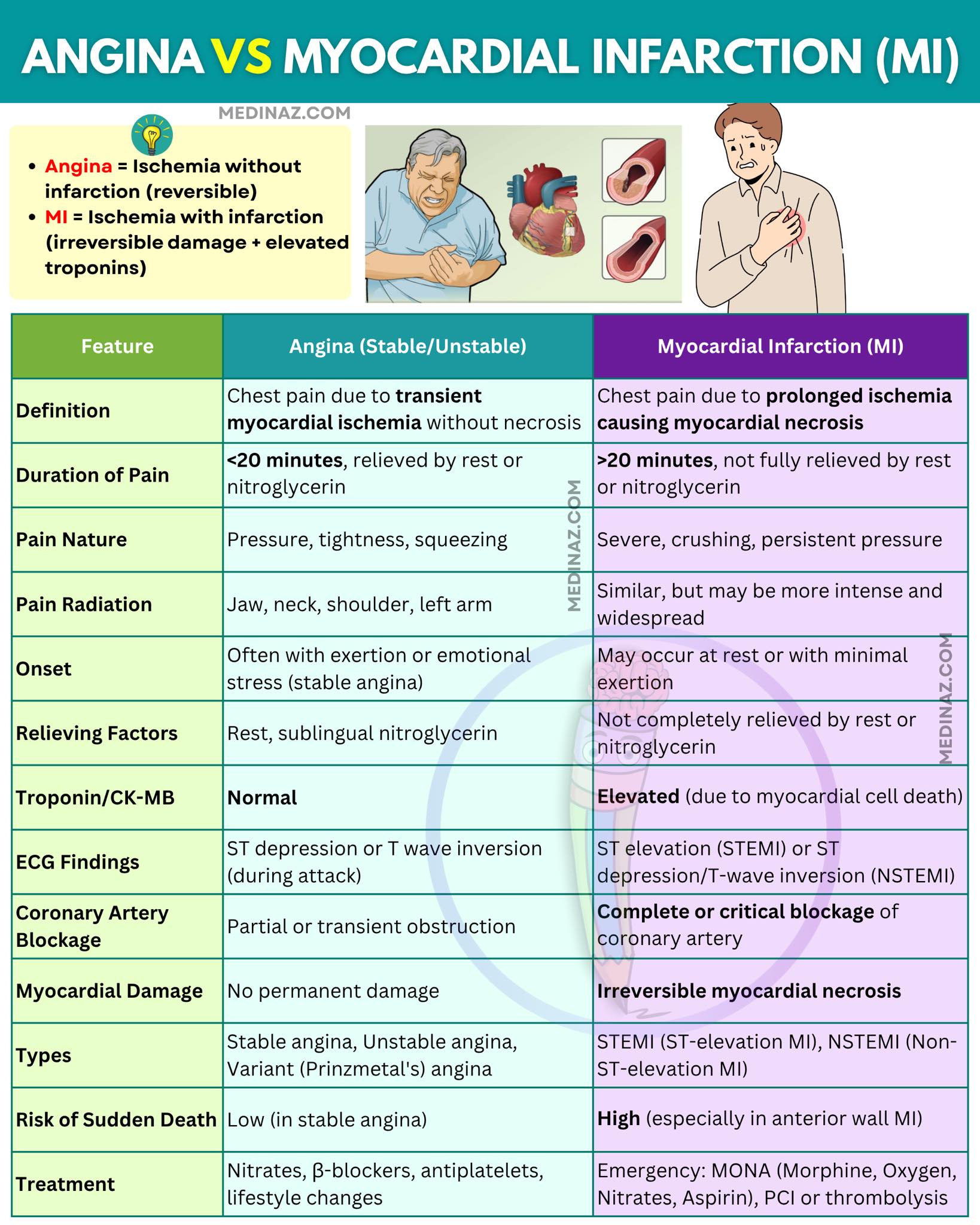 Medinaz - Angina Vs Myocardial Infarction | Facebook
