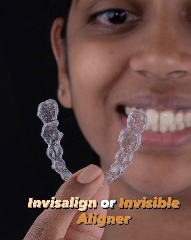 Dr.Kishor's - Invisalign vs invisible Aligner ? 🦷 1. What is an ...