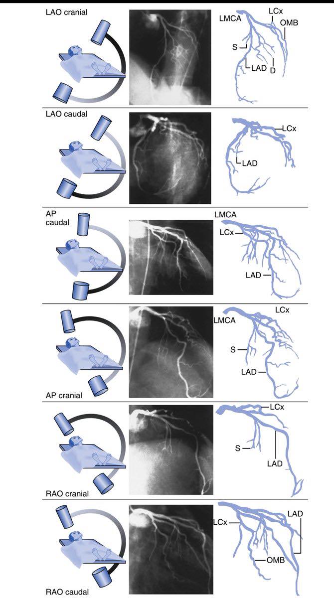 Cardiophilia - Standardized views for imaging the left coronary artery ...