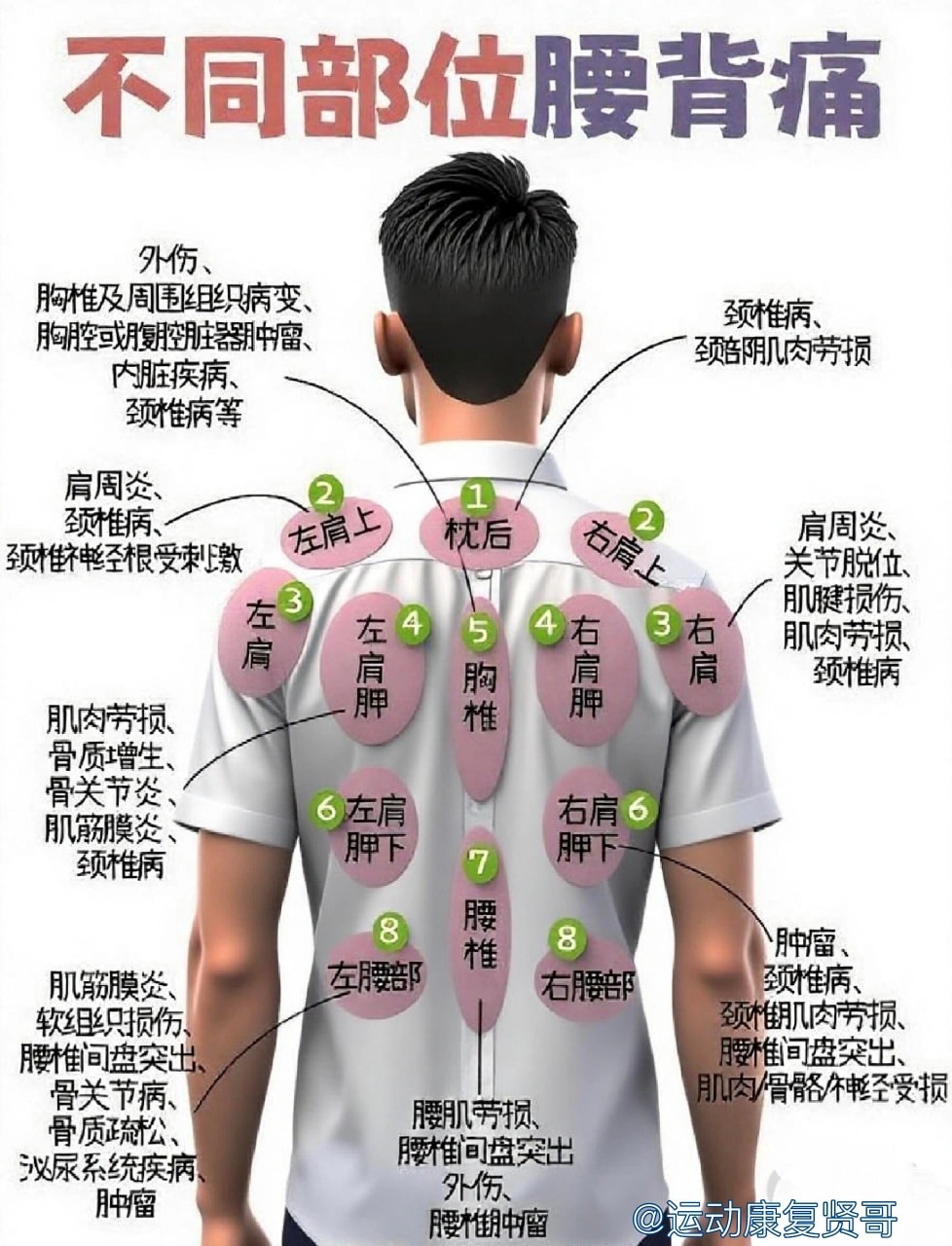 天城流医学大全集　症状別腰痛編 老娘要瘦- 腰背疼痛对照表，看看你哪里不舒服#如有不适请到正规医院