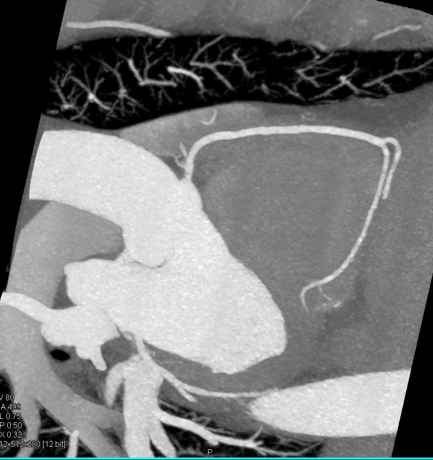 CTisus: Cutting edge information on body CT (Computed tomography ...