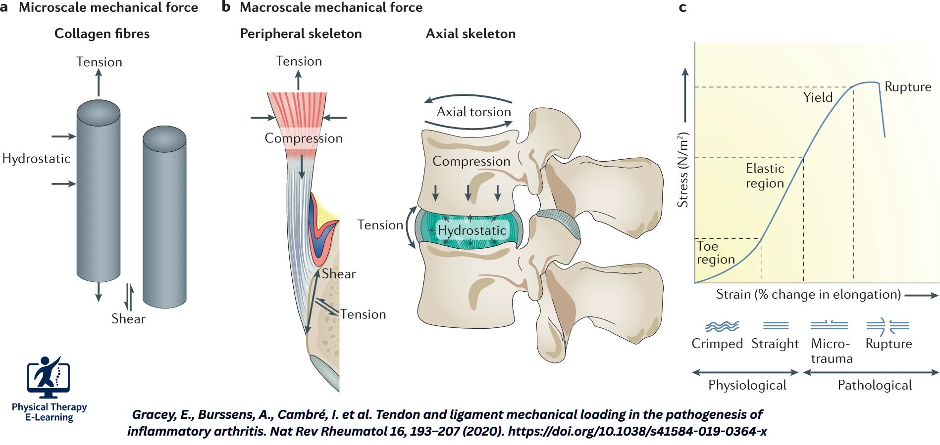 Physical - 📌Mechanical forces exerted on tendons and ligaments. The ...