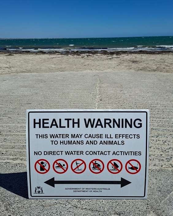 City - Health Warning – Algal Bloom ️ An algal bloom has been spotted ...