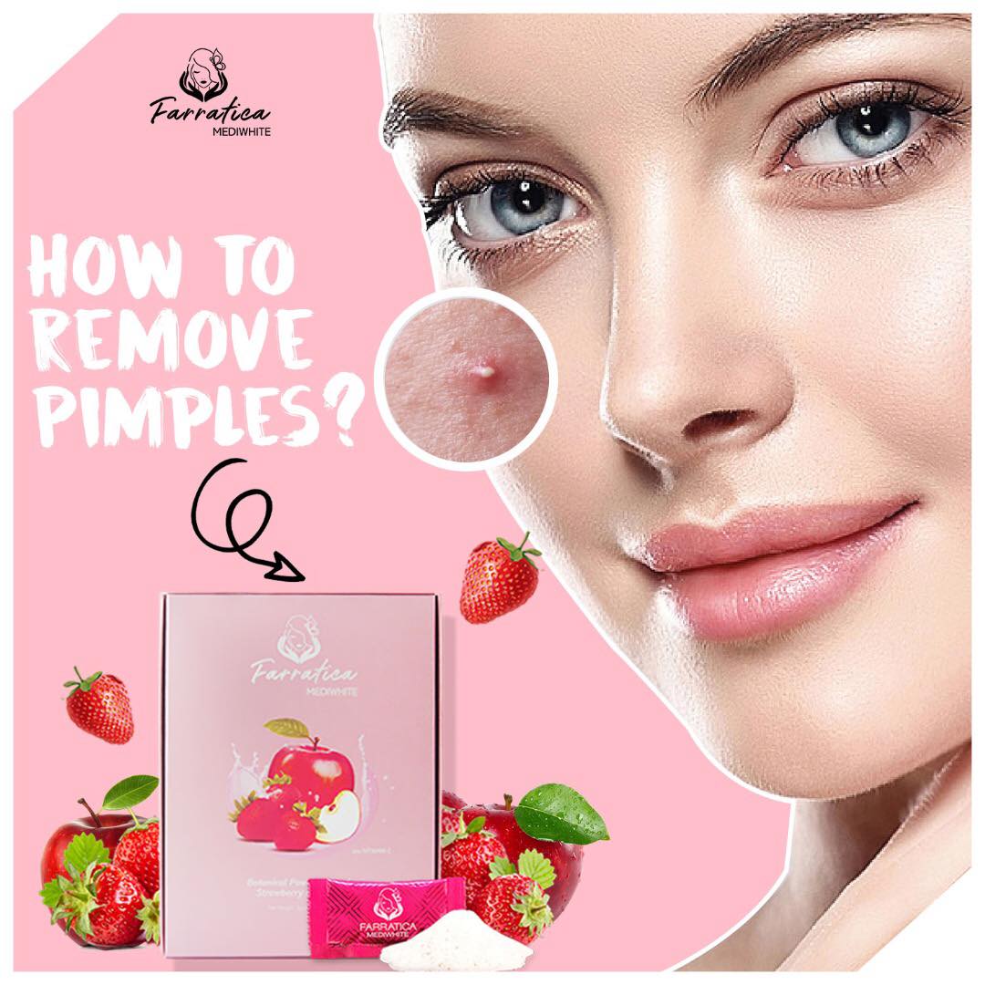 Beauty Tips How To Remove Pimples Farratica Beauty Hq Facebook