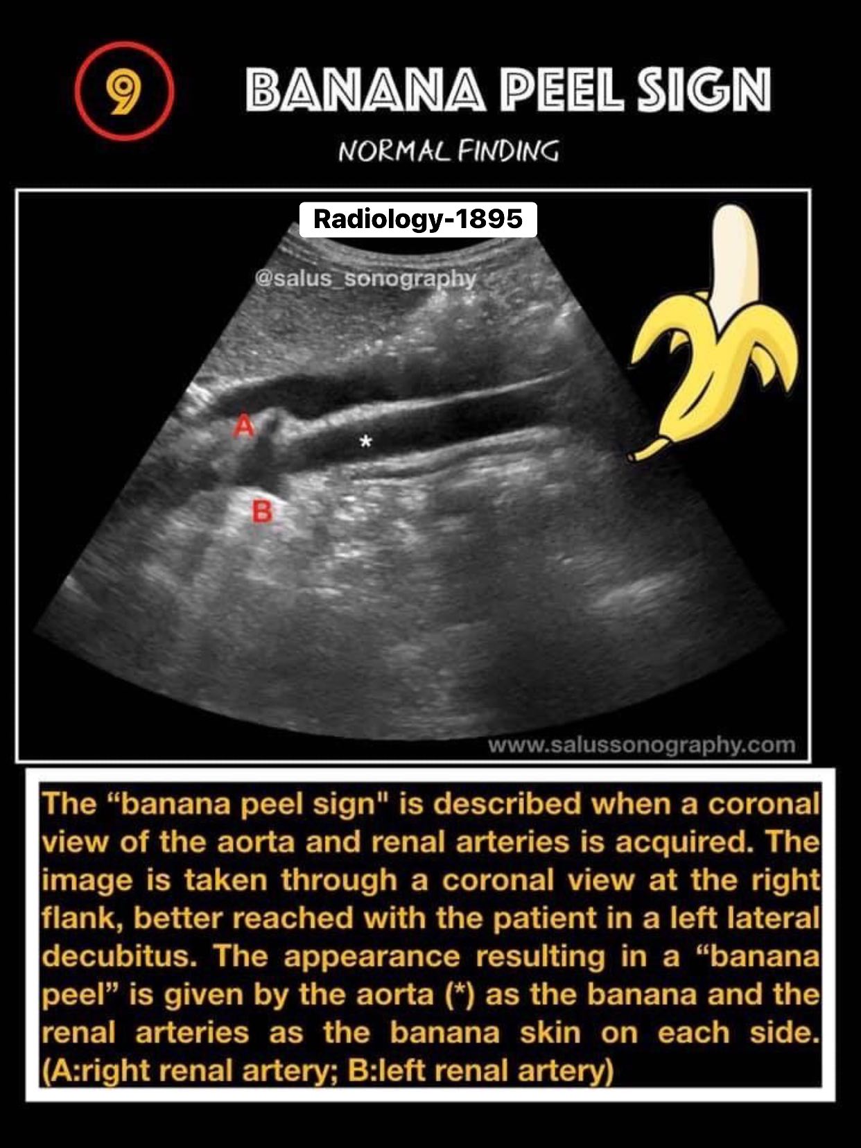 Banana Peels And Kidney Function In Dogs photo