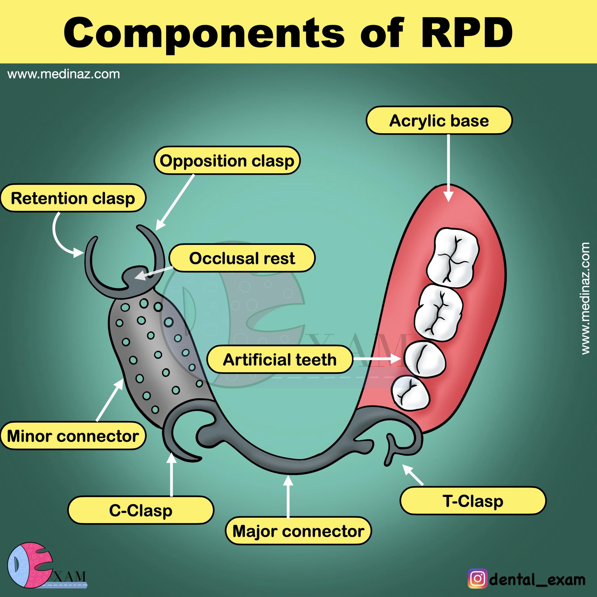 Dental - Components of RPD | Facebook