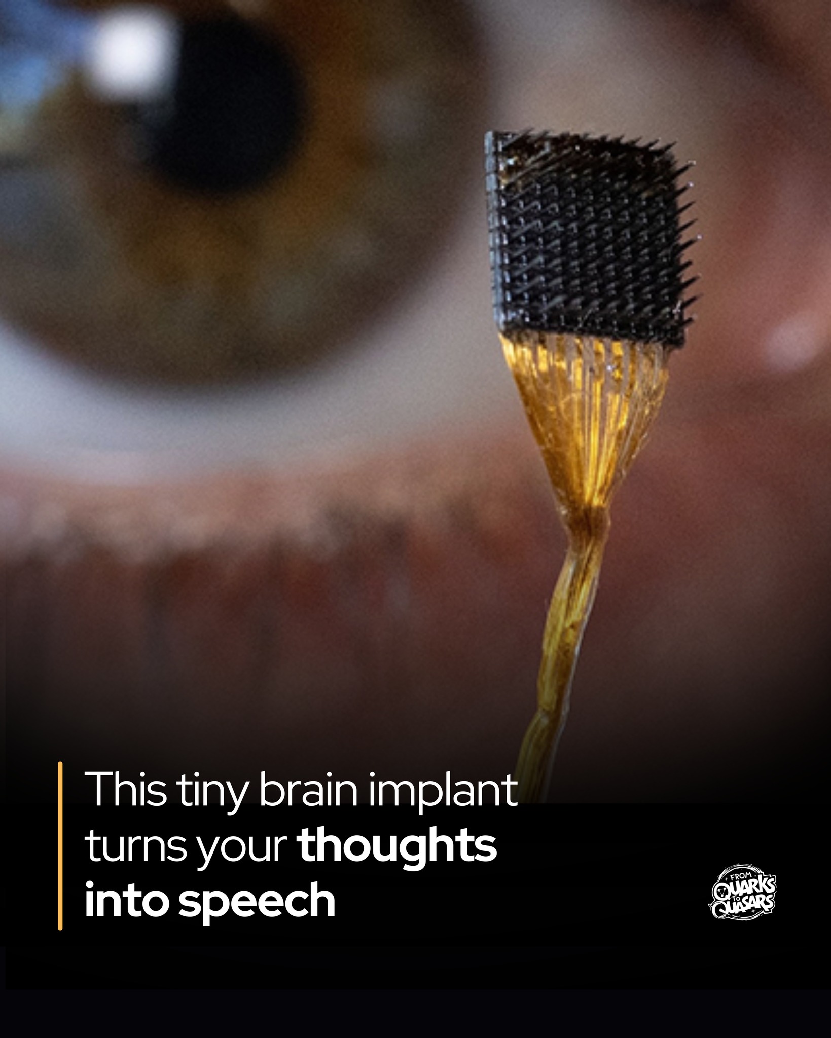 From - A groundbreaking brain implant is turning thoughts into speech ...