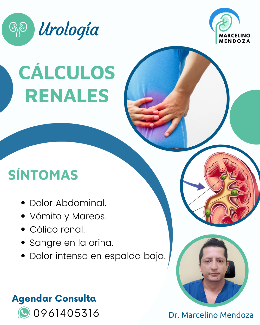 Dr. Marcelino Mendoza Urólogo - Los cálculos renales son masas sólidas ...
