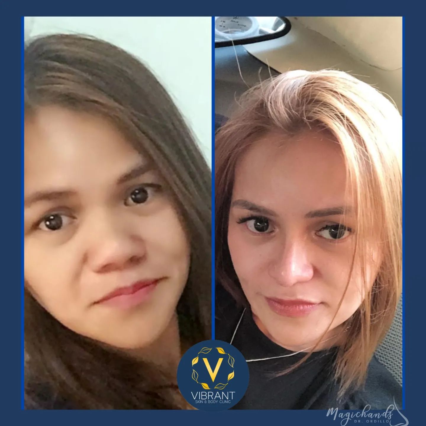 Vibrant Skin & Body Clinic by Dr. Ordillo - FACIAL HARMONY IS THE KEY ...