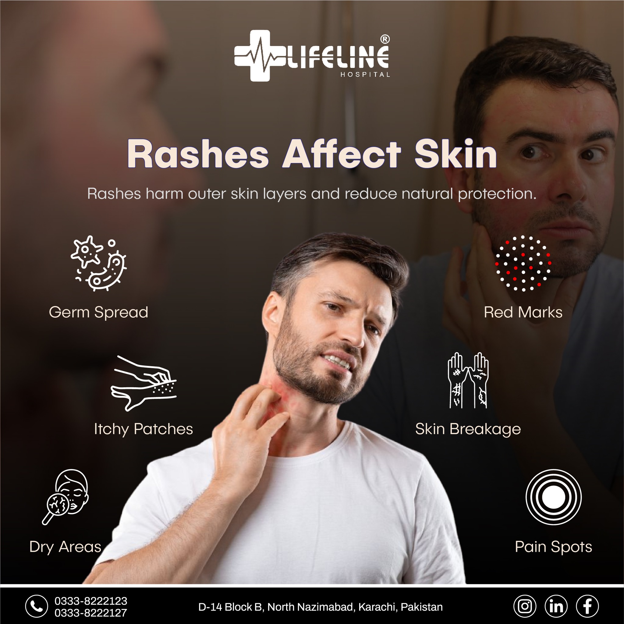 Lifeline-hospital - ⚠️ Rash flare-ups may trigger dryness, irritation ...