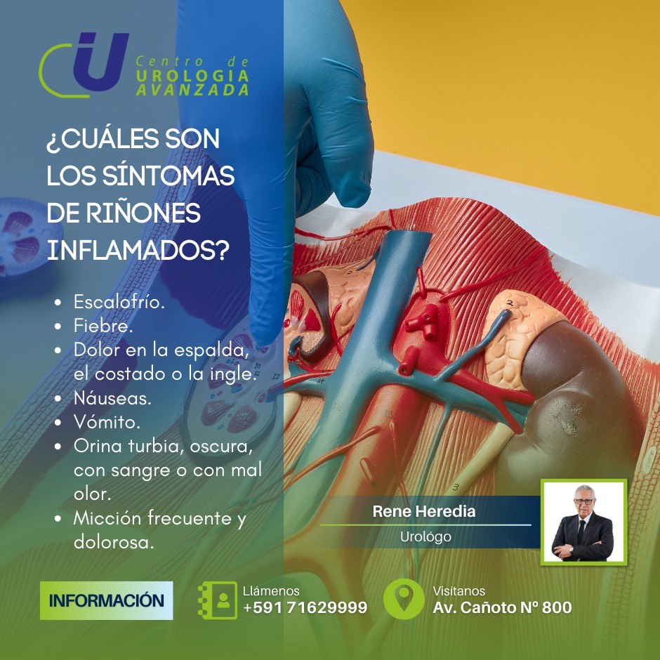 Dr. - ¿Cuáles son los síntomas de riñones inflamados? Escalofrío ...