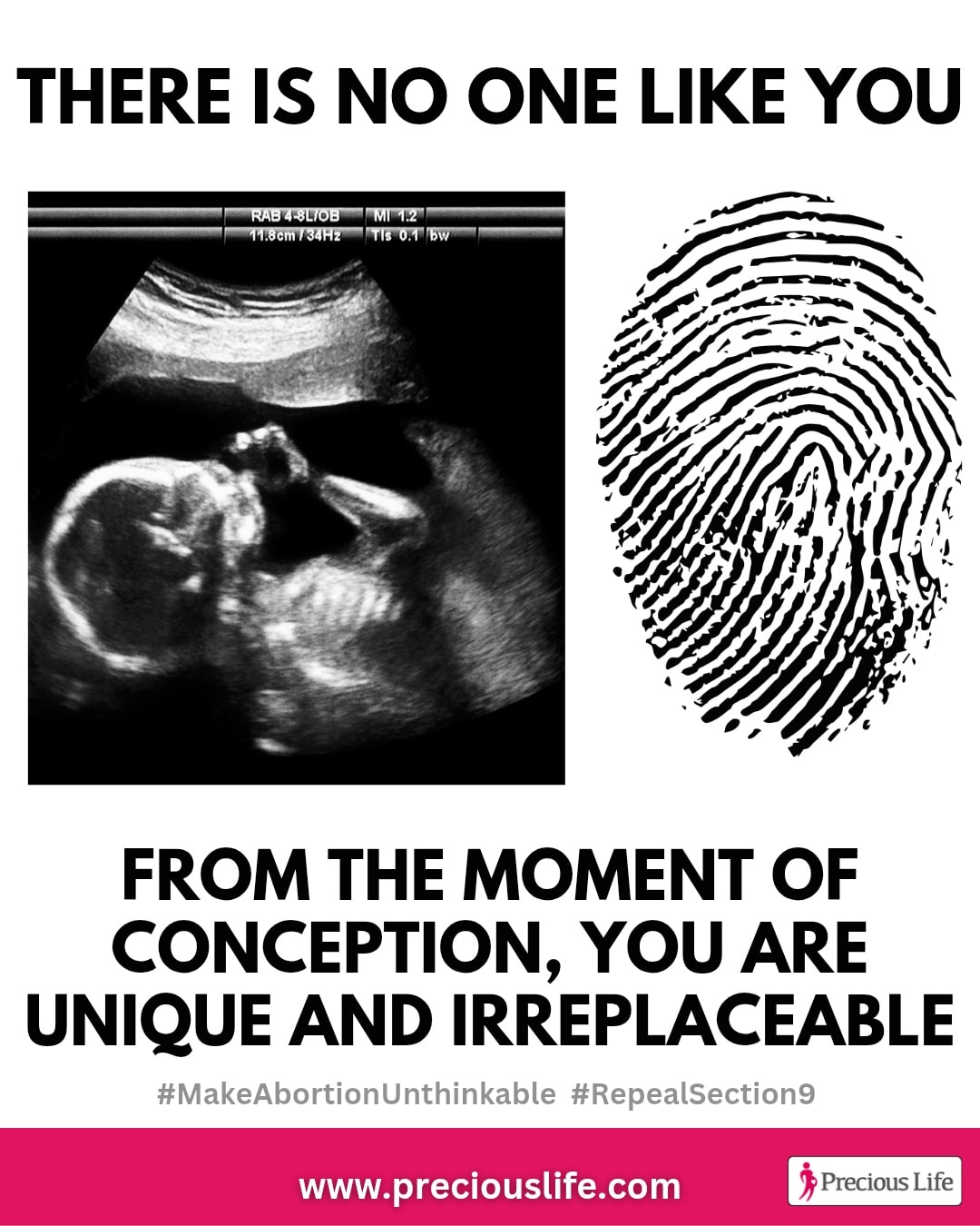 Precious - Sign the petition to restore full legal protection for ALL ...