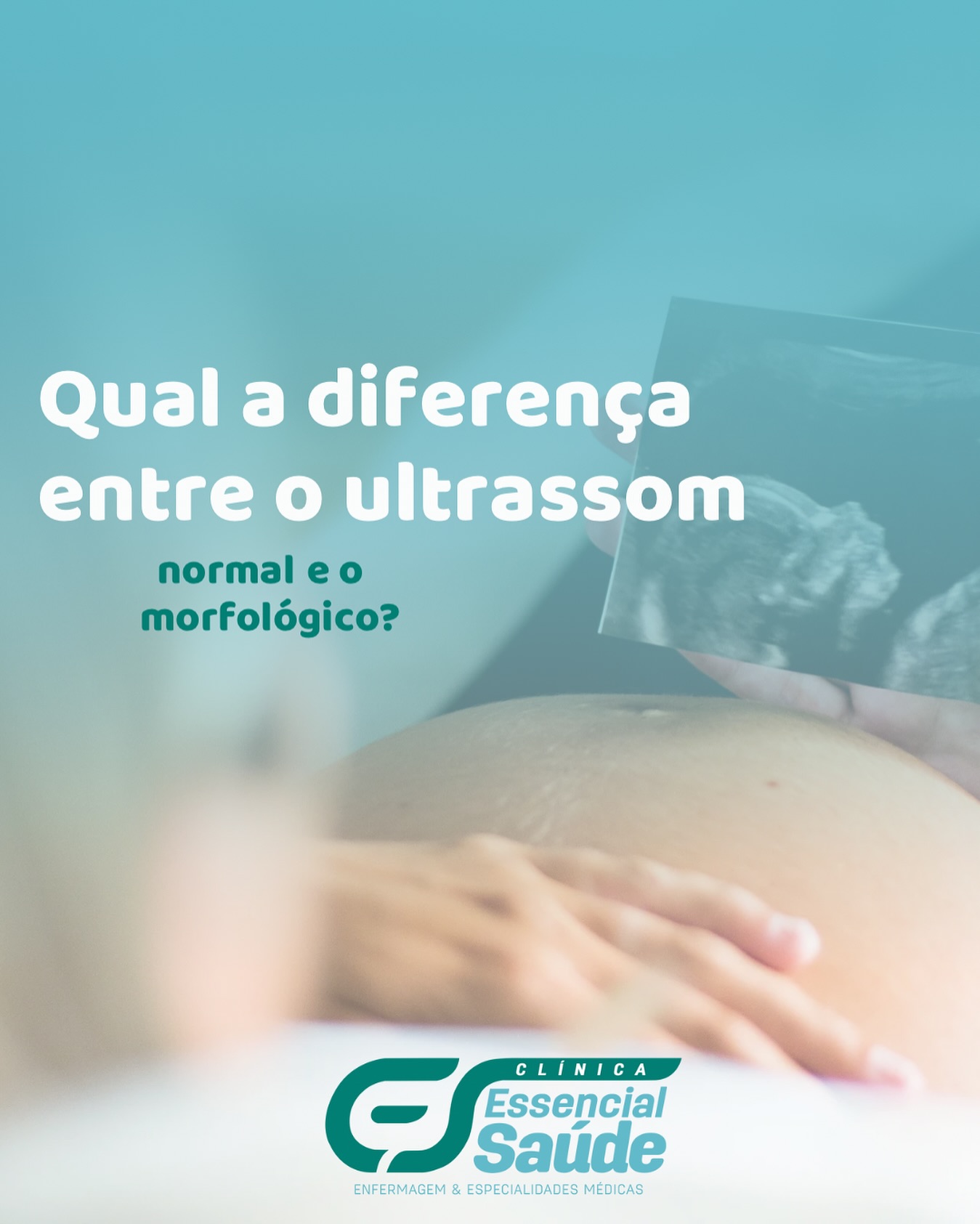 Clínica - 🔍 Ultrassom Normal (Obstétrico Comum) • 📅 Pode ser feito em ...