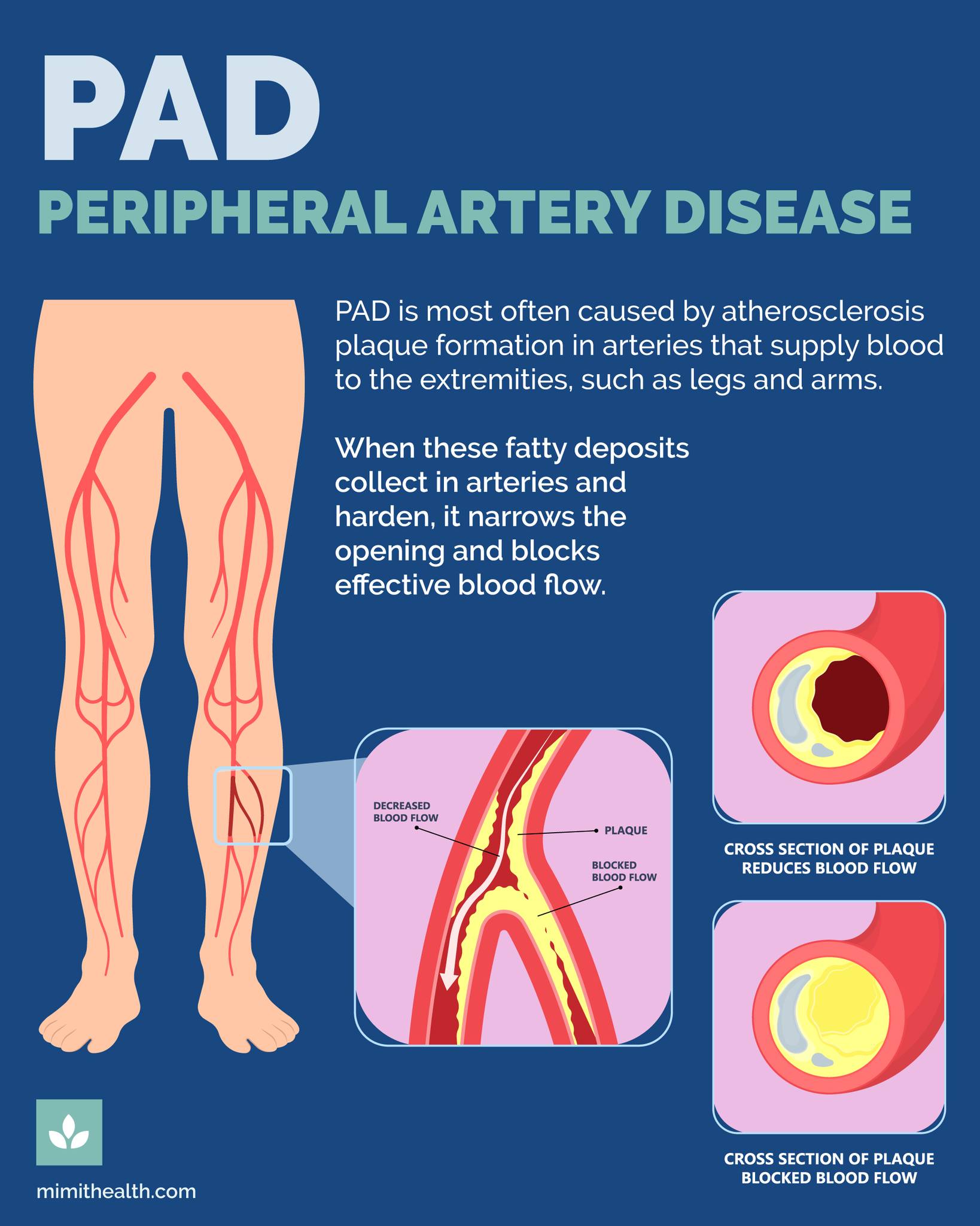 MIMIT Health - Midwest Institute for Minimally Invasive Therapies ...
